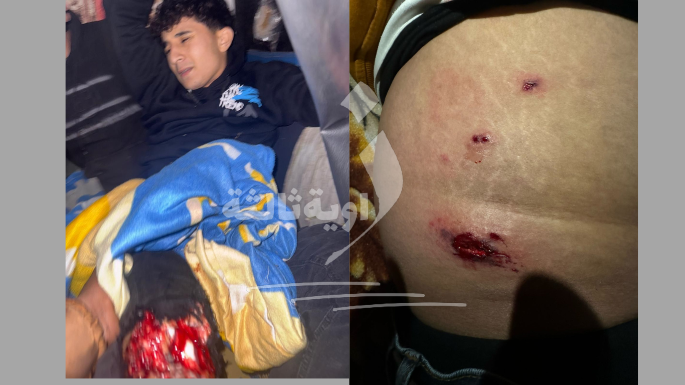 Photos d’un jeune blessé par balles et d’une blessure par balle, sur l’île d’Al-Warraq